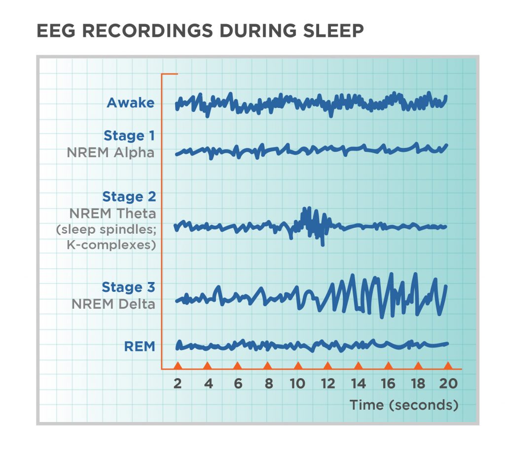 EEG Recordings During Sleep